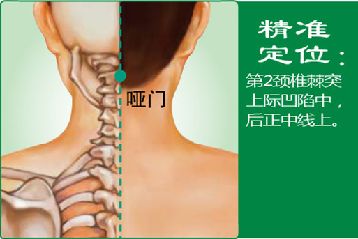 哑门_1.jpg