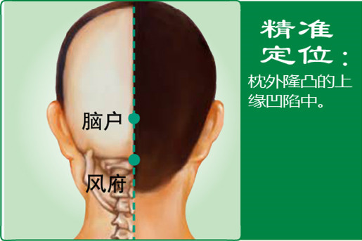 脑户_1.jpg