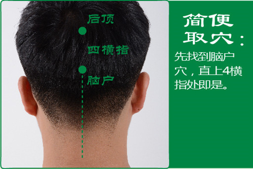 后顶_2.jpg