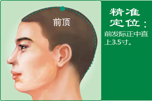 前顶_1.jpg