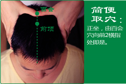 前顶_2.jpg