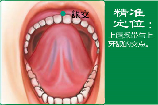 龈交_1.jpg