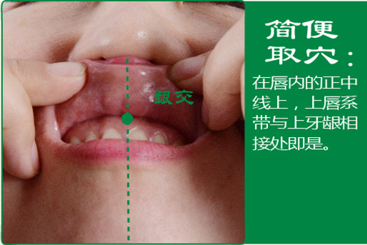 龈交_2.jpg
