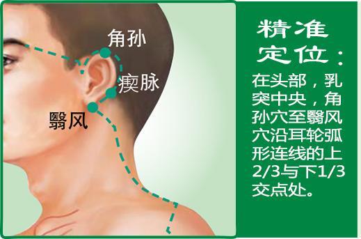 瘈脉(1).jpg