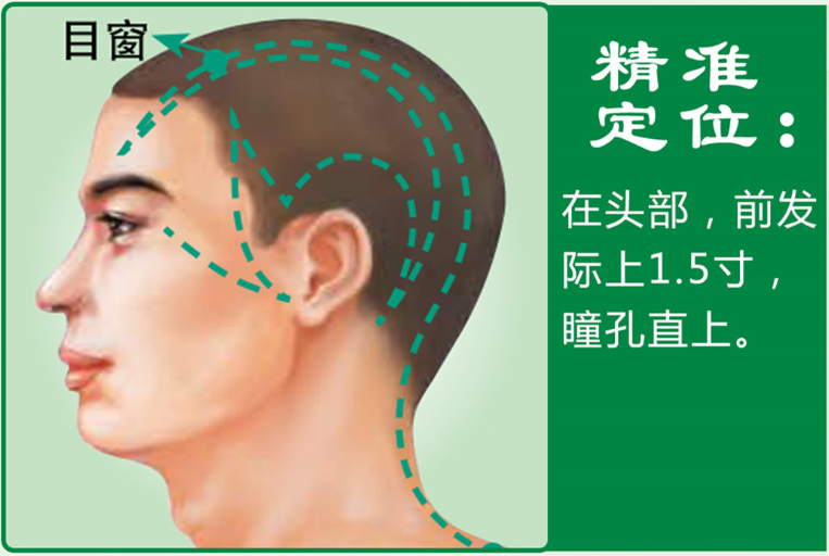 目窗.png